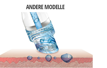 spray technologie 1 - Aquapure Kosmetik Behandlung